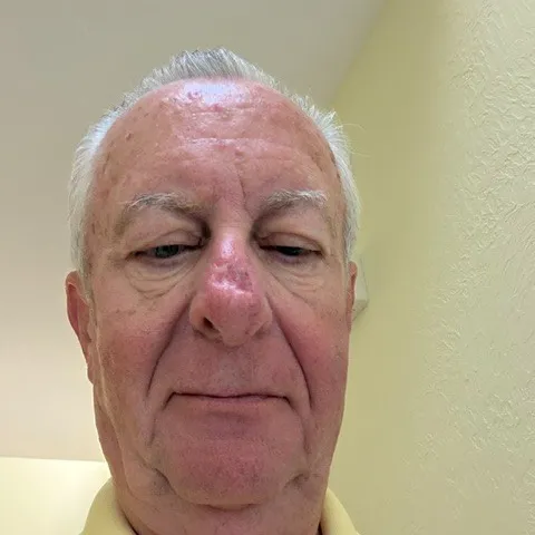 Dennis Brown Medicare Agent Canton, OH 44702 Dennis Brown Medicare Agent Canton, OH 44702